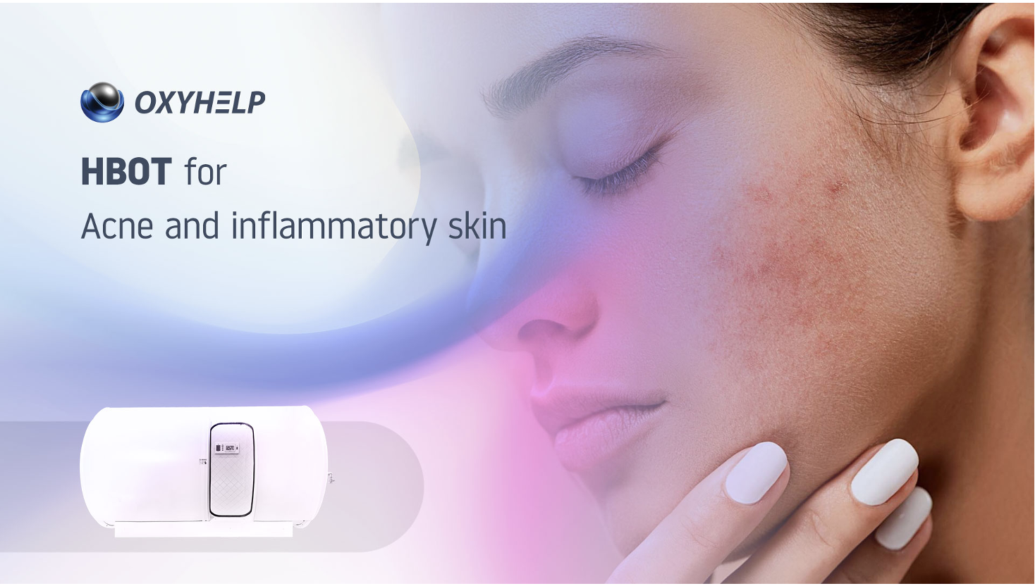 Unveiling The Potential: HBOT In Acne And Inflammatory Skin Conditions